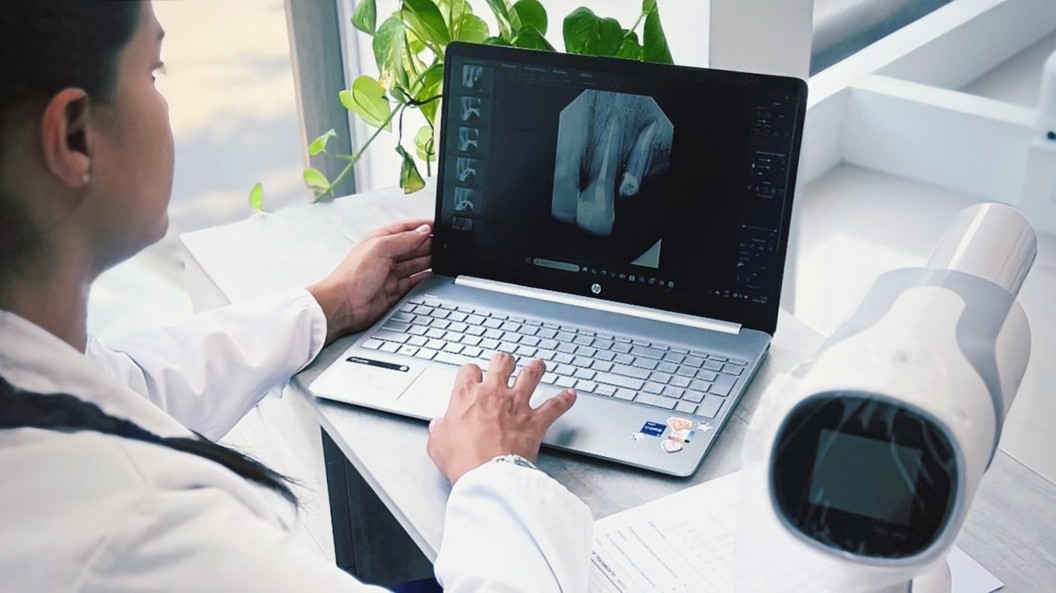 Carillas dentales estéticas para una sonrisa perfecta en UltraDental Lima