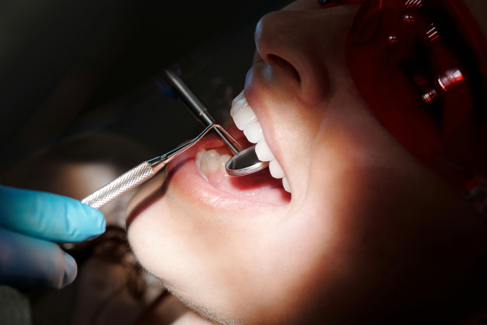 Cirugía bucal, extracciones e implantes en UltraDental Perú